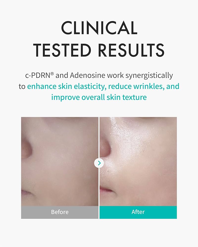 Rejuran Turnover Mask Box(5pcs)