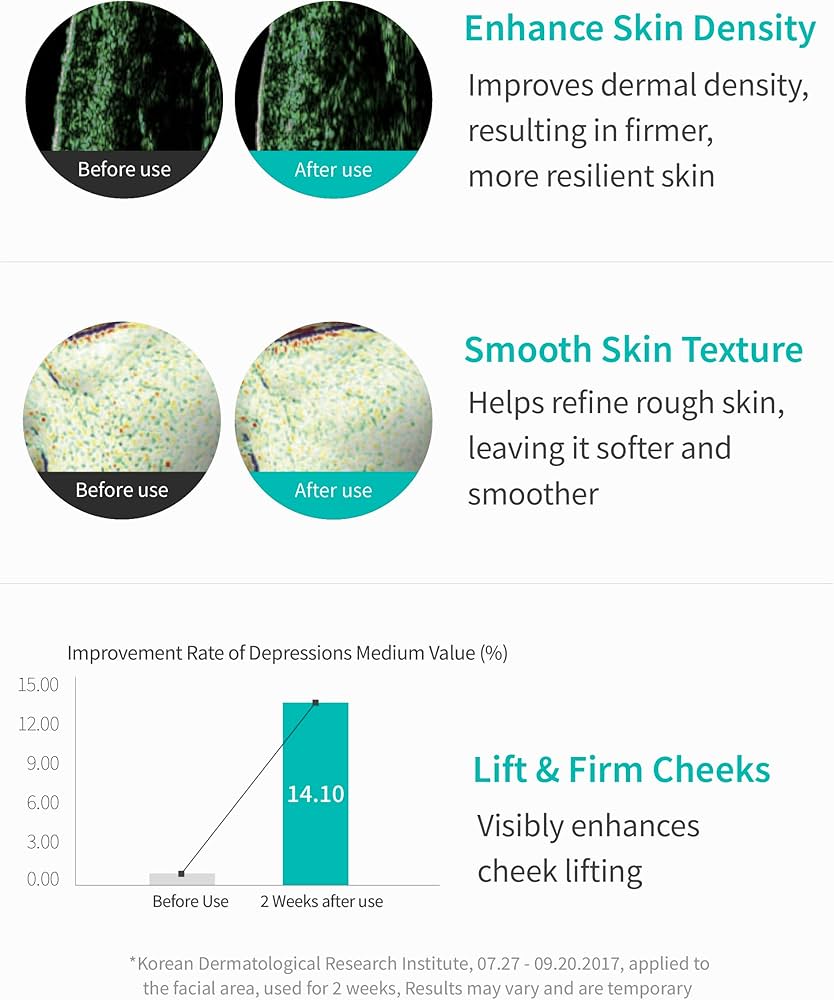 Rejuran Turnover Ampoule 30mL