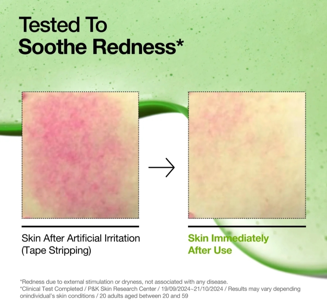 Anua Azelaic Acid 10 Hyaluron Soothing Serum