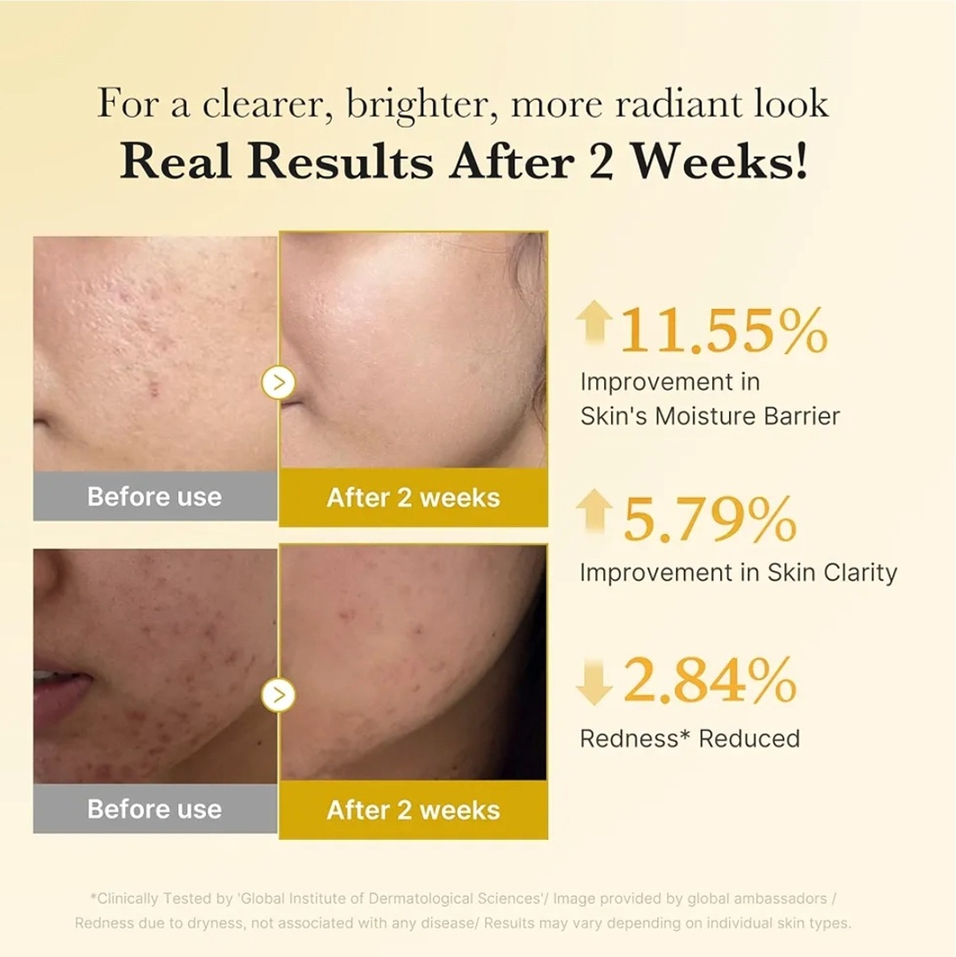 Medicube Kojic Acid Turmeric Niacinamide Serum