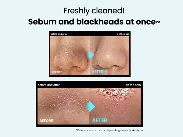 Ilso Sebum Melting Full Set